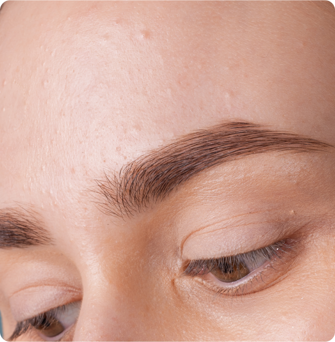 What does combination skin look and feel like? 