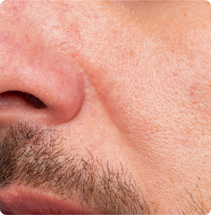 What does sensitive skin look and feel like? 