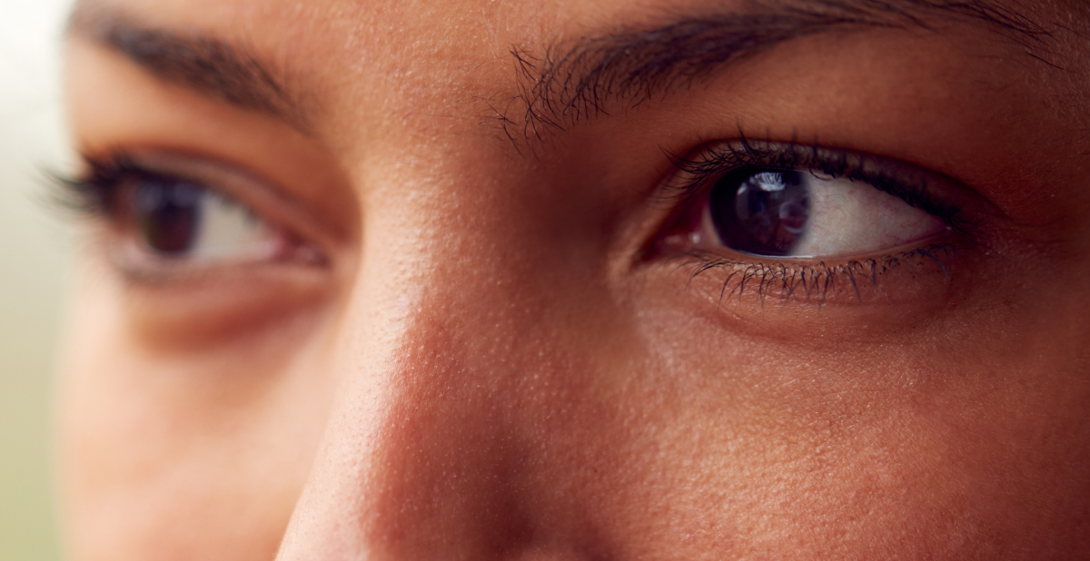 woman's eyes - what are dark circles?