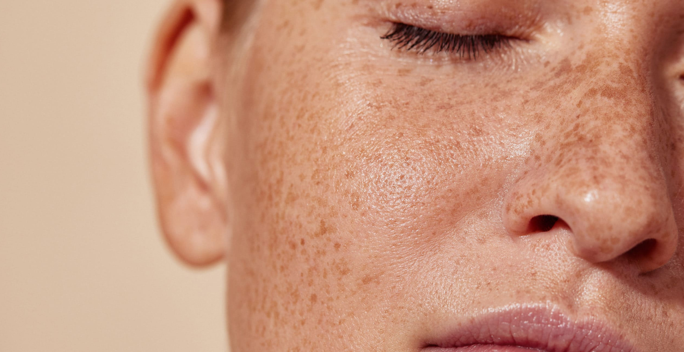 What does your skin’s microbiome do?