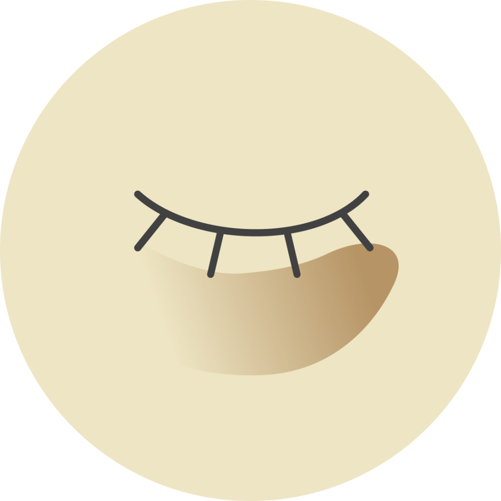 Pigmented dark circles