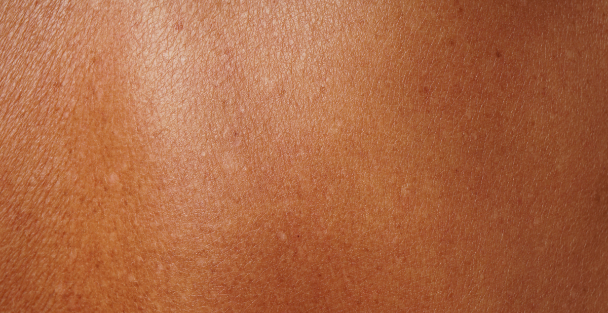 What is the skin made of_