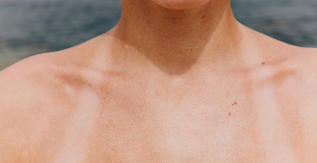 Tanned skin on a person's chest and shoulders with visible tan lines, taken at the beach.